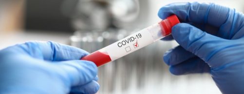 Kolejne badania kliniczne nad lekami na COVID-19 w Centrum Medycznym CMP
